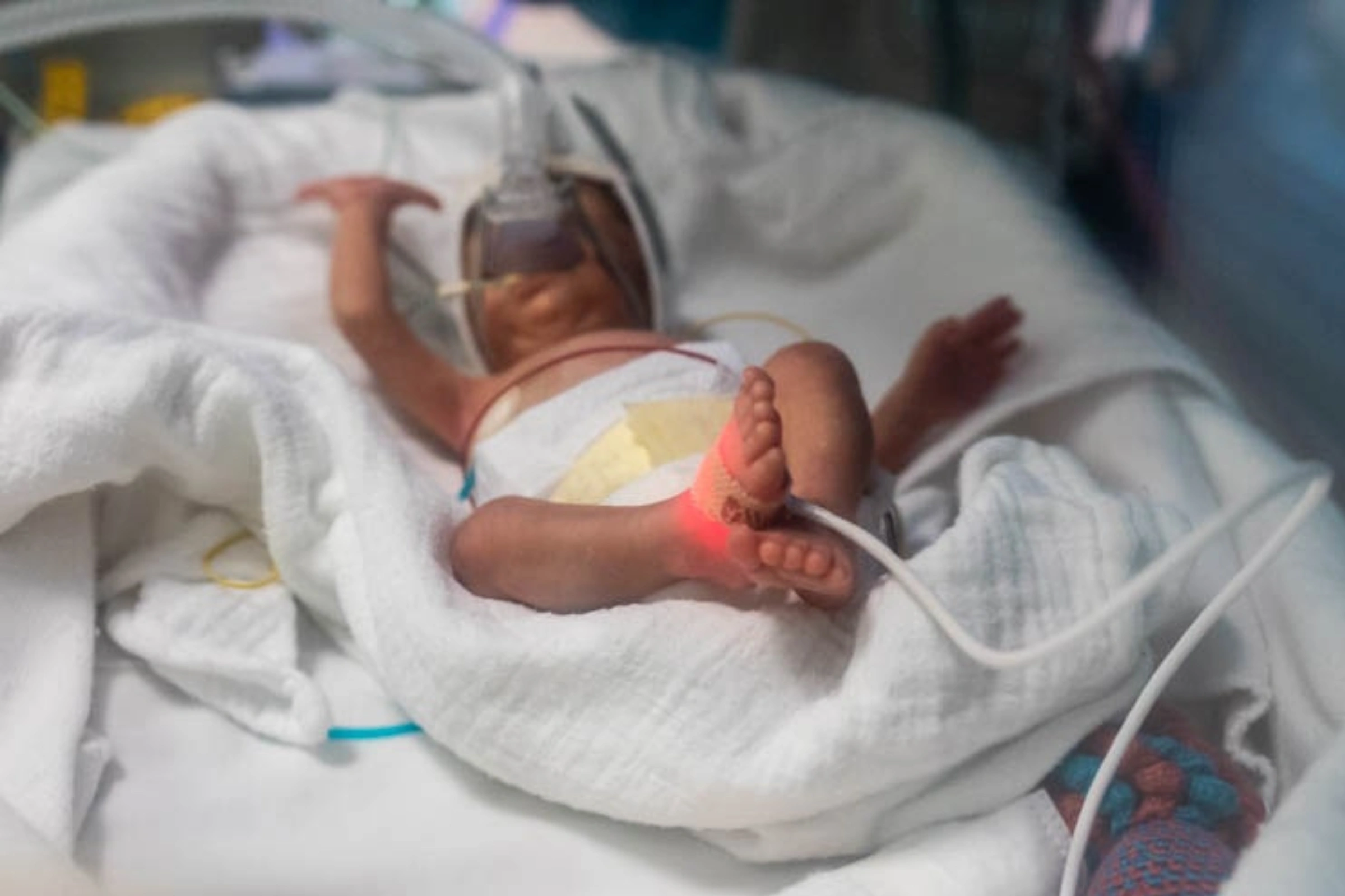 Selon l’EDSG 2019-2021, 18 bébés sur 1 000 ne survivent pas à leurs 28 premiers jours.