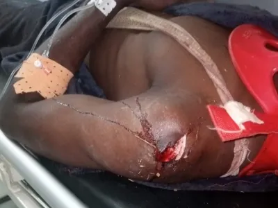 Marcel Madjou Mbani à son arrivée en soins intensifs.