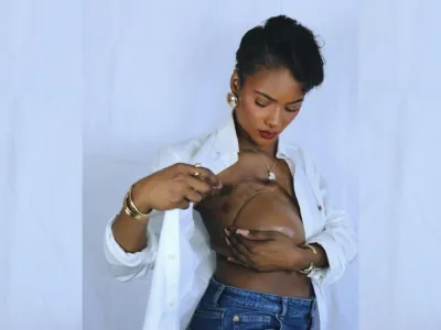 « Octobre n’a rien de rose » : le cri amer de Samantha Menie Prateaux face à la stigmatisation du cancer du sein